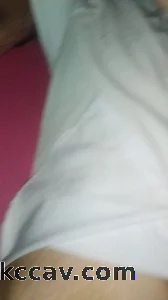 露脸，看看这个应该叫什么逼，毛太多了，怎么才能去毛。请指教。谢谢
