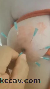 资深s调教女大母狗 穿刺