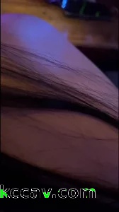 03年微熏医美前台直接拿下